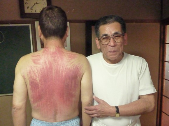 業捨」創業者（谷原弘倫氏）の施術とそれぞれに与える効果効能とは